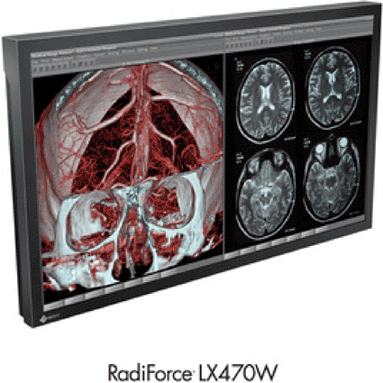Imagen: El RadiForce LX470W (Foto cortesía de Eizo). Imagen: El RadiForce LX470W (Foto cortesía de Eizo).